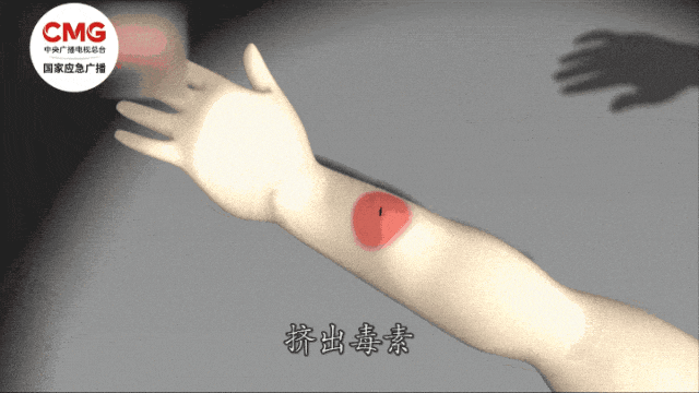 痛心！遭蜂群围攻，兄妹俩双双身亡，遇蜂群攻击怎么办→-1.jpg