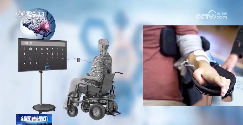 我国脑机接口技术走向临床 受试者体验如何？-1.jpg