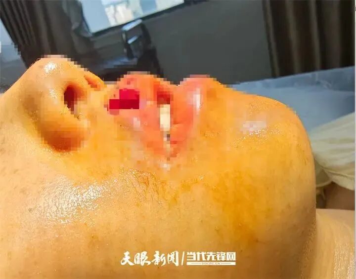 女子上门代喂，被100多斤阿拉斯加犬咬伤遭毁容，狗主人却称……-3.jpeg