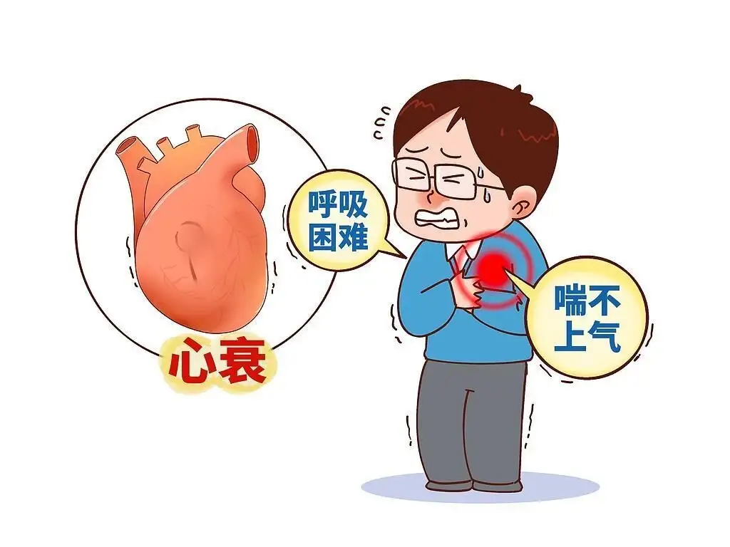 b533740a93bf54c411ac6329ee94d779.webp.webp